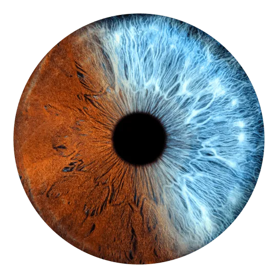 Iris azul e marrom misto